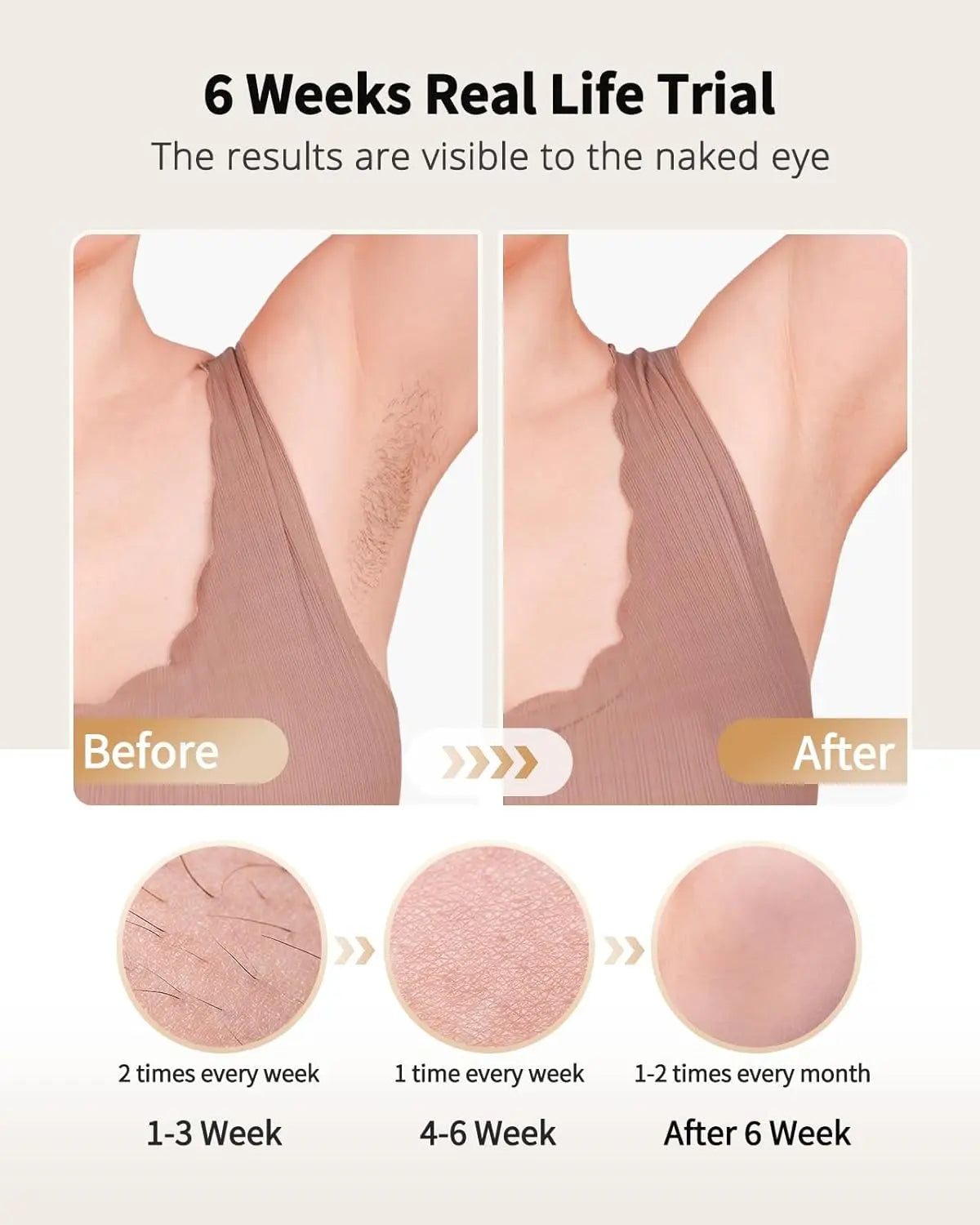 Unlimited Flashes Painless Epilator IPL Hair Remover